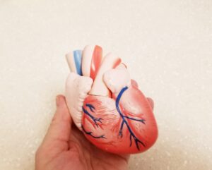 Human heart - cardiac radioablation
